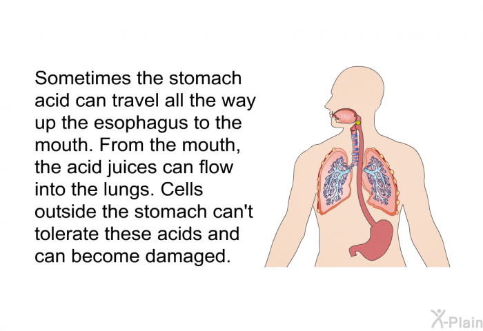 Sometimes the stomach acid can travel all the way up the esophagus to the mouth. From the mouth, the acid juices can flow into the lungs. Cells outside the stomach can't tolerate these acids and can become damaged.