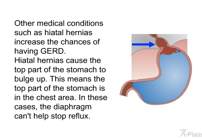 Other medical conditions such as hiatal hernias increase the chances of having GERD. Hiatal hernias cause the top part of the stomach to bulge up. This means the top part of the stomach is in the chest area. In these cases, the diaphragm can't help stop reflux.