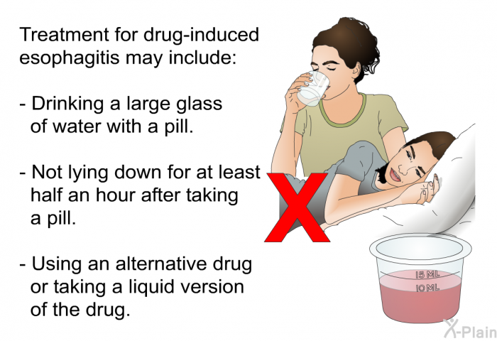 Treatment for drug-induced esophagitis may include:  Drinking a large glass of water with a pill. Not lying down for at least half an hour after taking a pill. Using an alternative drug or taking a liquid version of the drug.