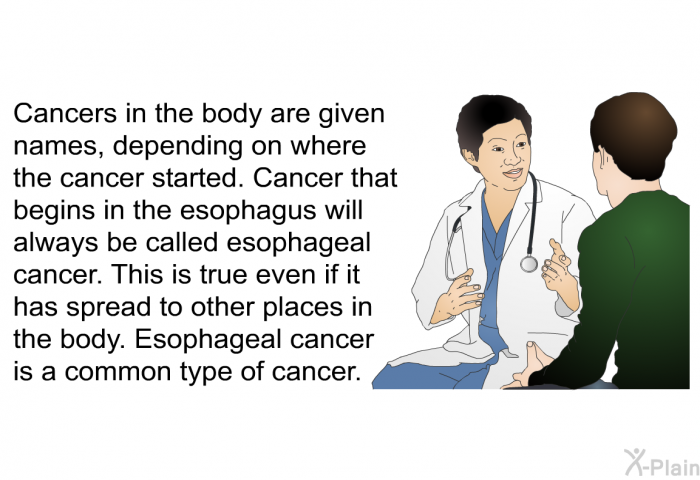 Cancers in the body are given names, depending on where the cancer started. Cancer that begins in the esophagus will always be called esophageal cancer. This is true even if it has spread to other places in the body. Esophageal cancer is a common type of cancer.