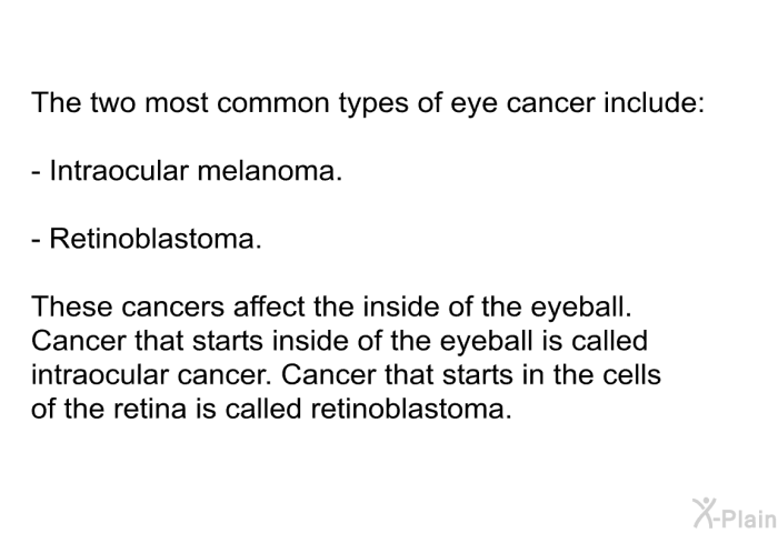 The two most common types of eye cancer include:  Intraocular melanoma. Retinoblastoma.  
 These cancers affect the inside of the eyeball. Cancer that starts inside of the eyeball is called intraocular cancer. Cancer that starts in the cells of the retina is called retinoblastoma.