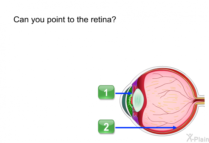 Can you point to the retina?