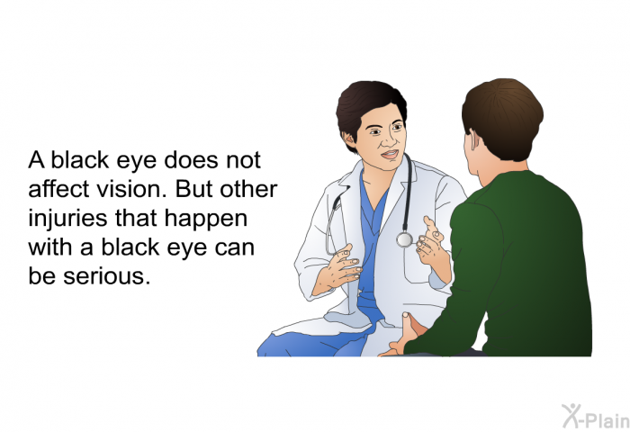 A black eye does not affect vision. But other injuries that happen with a black eye can be serious.
