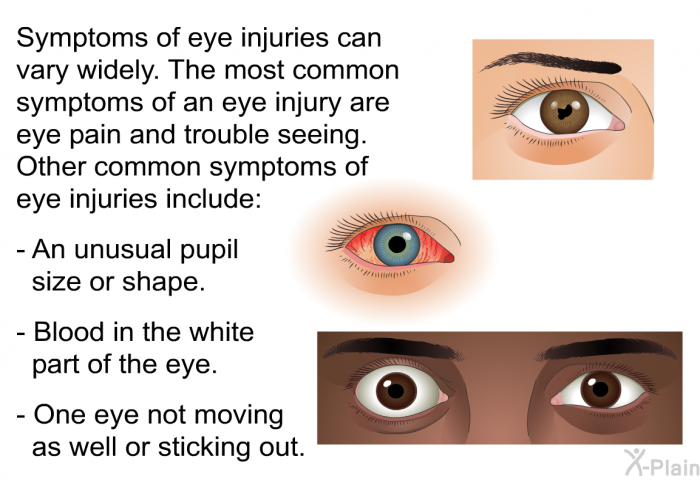 Symptoms of eye injuries can vary widely. The most common symptoms of an eye injury are eye pain and trouble seeing. Other common symptoms of eye injuries include:  An unusual pupil size or shape. Blood in the white part of the eye. One eye not moving as well or sticking out.