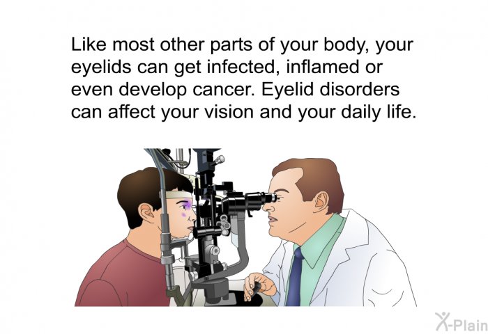Like most other parts of your body, your eyelids can get infected, inflamed or even develop cancer. Eyelid disorders can affect your vision and your daily life.