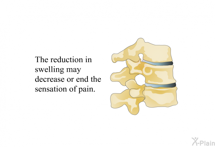 The reduction in swelling may decrease or end the sensation of pain.