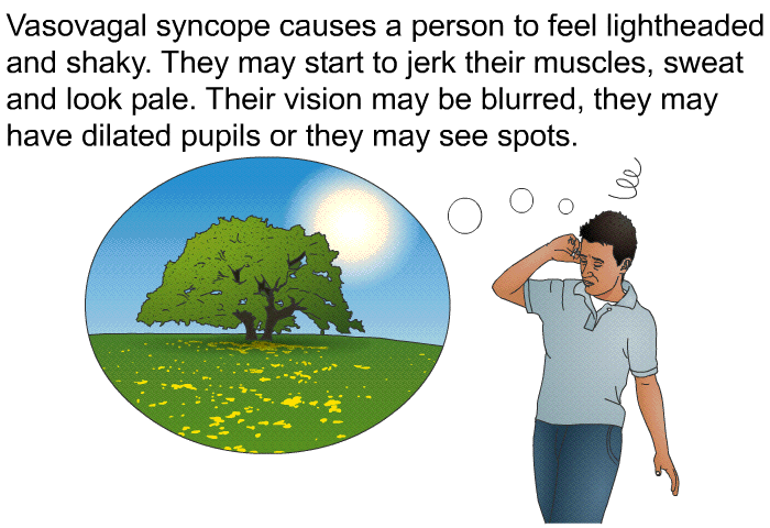 Vasovagal syncope causes a person to feel lightheaded and shaky. They may start to jerk their muscles, sweat and look pale. Their vision may be blurred, they may have dilated pupils or they may see spots.