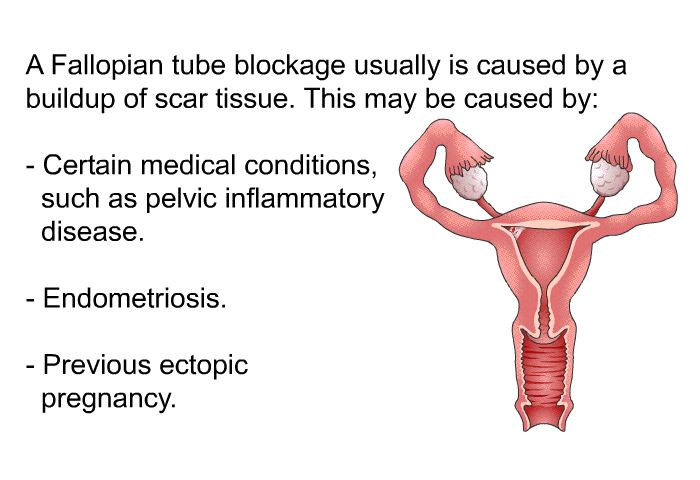A Fallopian tube blockage usually is caused by a buildup of scar tissue. This may be caused by:  Certain medical conditions, such as pelvic inflammatory disease. Endometriosis. Previous ectopic pregnancy.