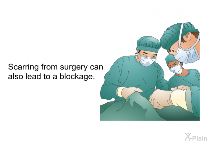 Scarring from surgery can also lead to a blockage.