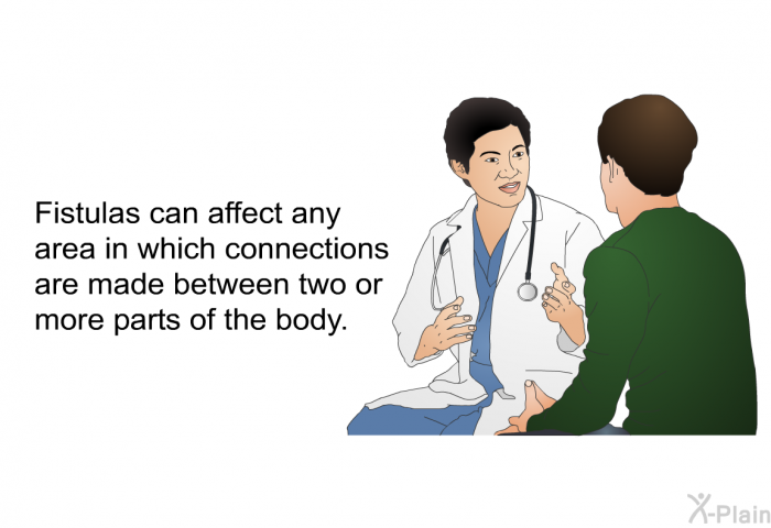 Fistulas can affect any area in which connections are made between two or more parts of the body.