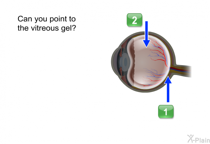 Can you point to the vitreous gel?