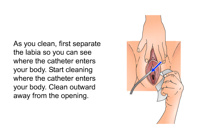 As you clean, first separate the labia so you can see where the catheter enters your body. Start cleaning where the catheter enters your body. Clean outward away from the opening.