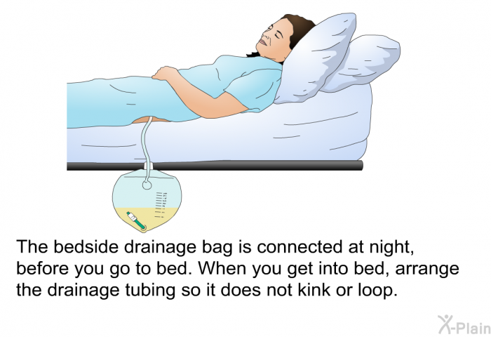 The bedside drainage bag is connected at night, before you go to bed. When you get into bed, arrange the drainage tubing so it does not kink or loop.