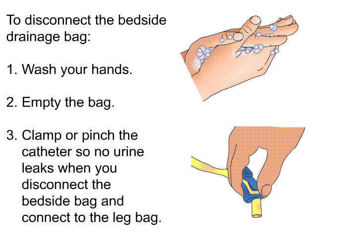 To disconnect the bedside drainage bag:  Wash your hands. Empty the bag. Clamp or pinch the catheter so no urine leaks when you disconnect the bedside bag and connect to the leg bag.