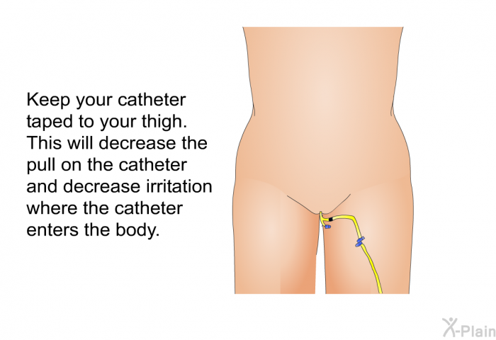 Keep your catheter taped to your thigh. This will decrease the pull on the catheter and decrease irritation where the catheter enters the body.