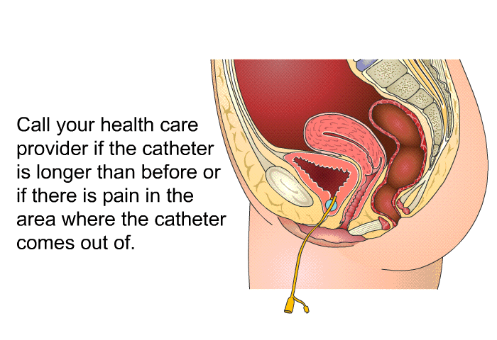 Call your health care provider if the catheter is longer than before or if there is pain in the area where the catheter comes out of.