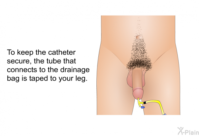 To keep the catheter secure, the tube that connects to the drainage bag is taped to your leg.