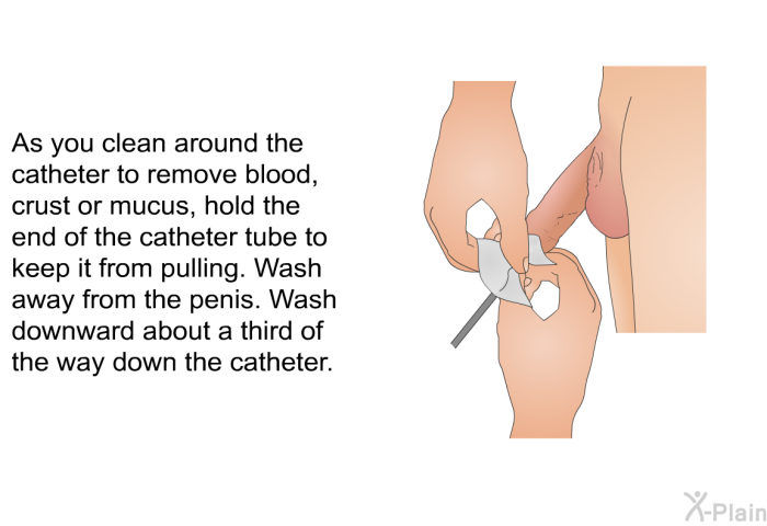 As you clean around the catheter to remove blood, crust or mucus, hold the end of the catheter tube to keep it from pulling. Wash away from the penis. Wash downward about a third of the way down the catheter.