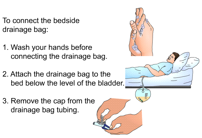 To connect the bedside drainage bag:  Wash your hands before connecting the drainage bag. Attach the drainage bag to the bed below the level of the bladder. Remove the cap from the drainage bag tubing.