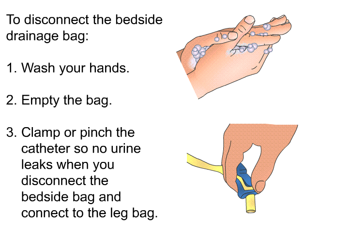 To disconnect the bedside drainage bag:  Wash your hands. Empty the bag. Clamp or pinch the catheter so no urine leaks when you disconnect the bedside bag and connect to the leg bag.