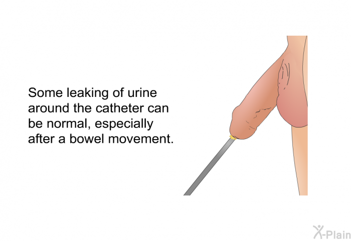Some leaking of urine around the catheter can be normal, especially after a bowel movement.