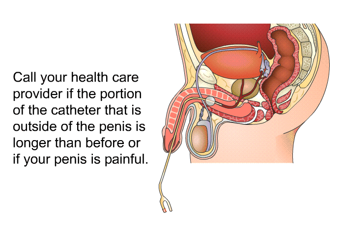 Call your health care provider if the portion of the catheter that is outside of the penis is longer than before or if your penis is painful.