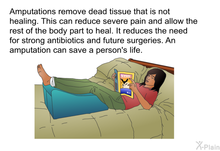 Amputations remove dead tissue that is not healing. This can reduce severe pain and allow the rest of the body part to heal. It reduces the need for strong antibiotics and future surgeries. An amputation can save a person's life.
