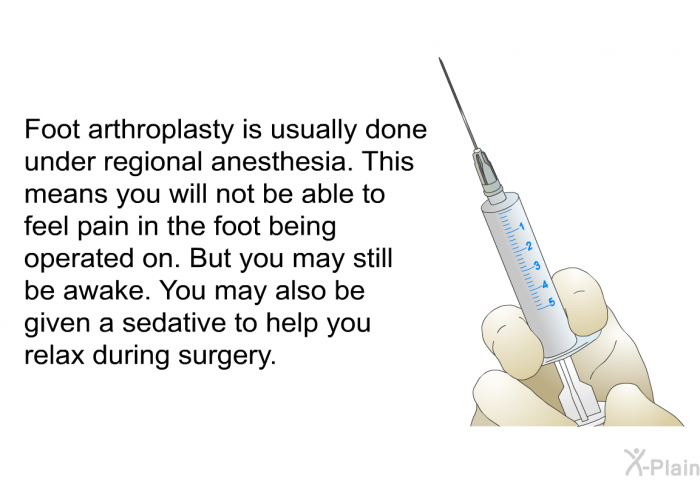 Foot arthroplasty is usually done under regional anesthesia. This means you will not be able to feel pain in the foot being operated on. But you may still be awake. You may also be given a sedative to help you relax during surgery.