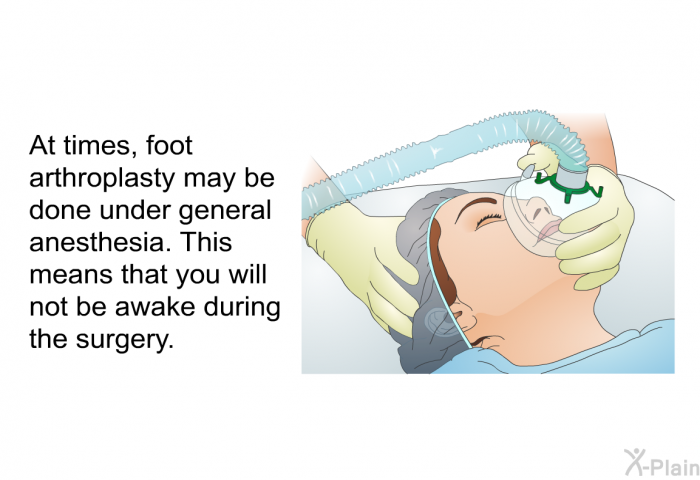 At times, foot arthroplasty may be done under general anesthesia. This means that you will not be awake during the surgery.