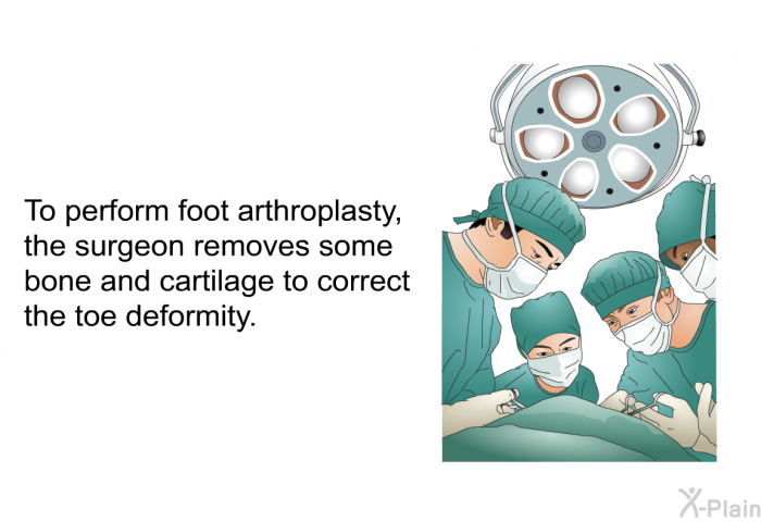 To perform foot arthroplasty, the surgeon removes some bone and cartilage to correct the toe deformity.