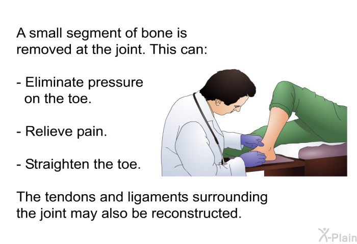 A small segment of bone is removed at the joint. This can:  Eliminate pressure on the toe. Relieve pain. Straighten the toe.  
 The tendons and ligaments surrounding the joint may also be reconstructed.