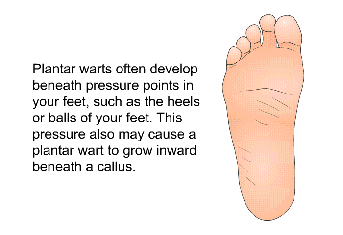Plantar warts often develop beneath pressure points in your feet, such as the heels or balls of your feet. This pressure also may cause a plantar wart to grow inward beneath a callus.