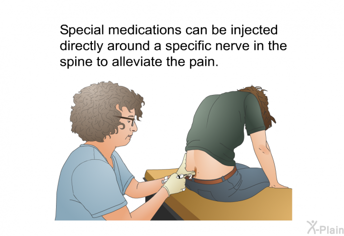Special medications can be injected directly around a specific nerve in the spine to alleviate the pain.