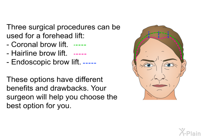 Three surgical procedures can be used for a forehead lift:  Coronal brow lift. Hairline brow lift. Endoscopic brow lift.  
 These options have different benefits and drawbacks. Your surgeon will help you choose the best option for you.