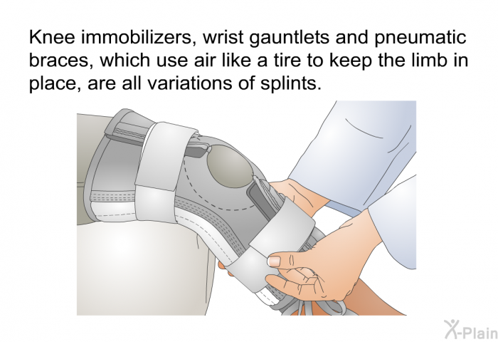 Knee immobilizers, wrist gauntlets and pneumatic braces, which use air like a tire to keep the limb in place, are all variations of splints.