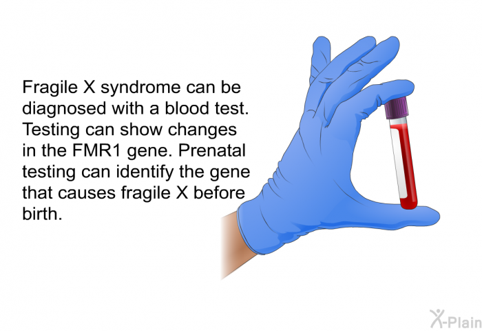 Fragile X syndrome can be diagnosed with a blood test. Testing can show changes in the FMR1 gene. Prenatal testing can identify the gene that causes fragile X before birth.