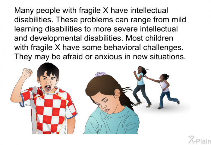 Many people with fragile X have intellectual disabilities. These problems can range from mild learning disabilities to more severe intellectual and developmental disabilities. Most children with fragile X have some behavioral challenges. They may be afraid or anxious in new situations.