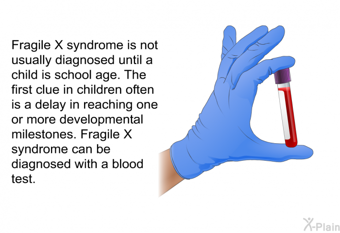Fragile X syndrome is not usually diagnosed until a child is school age. The first clue in children often is a delay in reaching one or more developmental milestones. Fragile X syndrome can be diagnosed with a blood test.