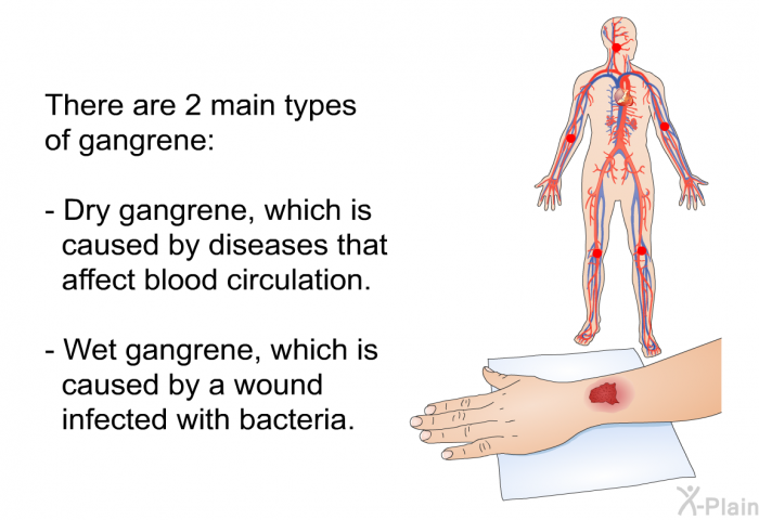 There are 2 main types of gangrene:  Dry gangrene, which is caused by diseases that affect blood circulation. Wet gangrene, which is caused by a wound infected with bacteria.