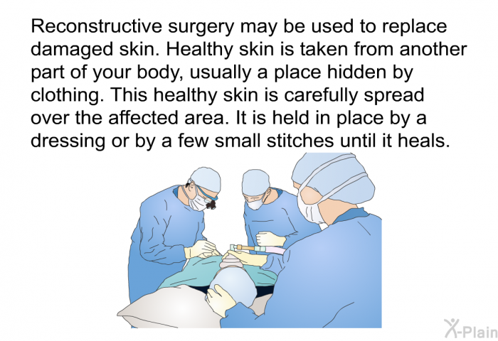 Reconstructive surgery may be used to replace damaged skin. Healthy skin is taken from another part of your body, usually a place hidden by clothing. This healthy skin is carefully spread over the affected area. It is held in place by a dressing or by a few small stitches until it heals.
