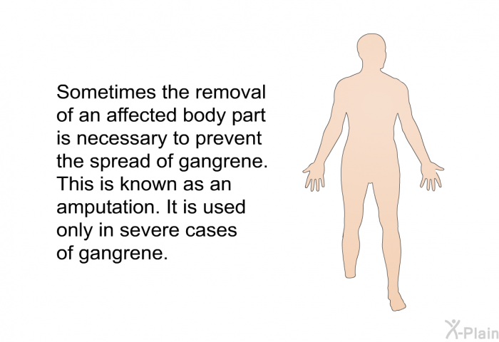 Sometimes the removal of an affected body part is necessary to prevent the spread of gangrene. This is known as an amputation. It is used only in severe cases of gangrene.