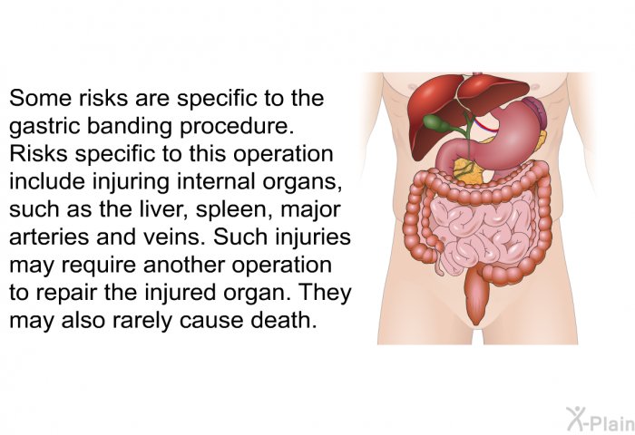 Some risks are specific to the gastric banding procedure. Risks specific to this operation include injuring internal organs, such as the liver, spleen, major arteries and veins. Such injuries may require another operation to repair the injured organ. They may also rarely cause death.