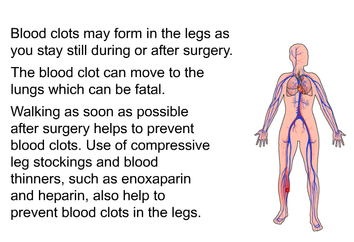 Blood clots may form in the legs as you stay still during or after surgery. The blood clot can move to the lungs which can be fatal. Walking as soon as possible after surgery helps to prevent blood clots. Use of compressive leg stockings and blood thinners, such as enoxaparin and heparin, also help to prevent blood clots in the legs.