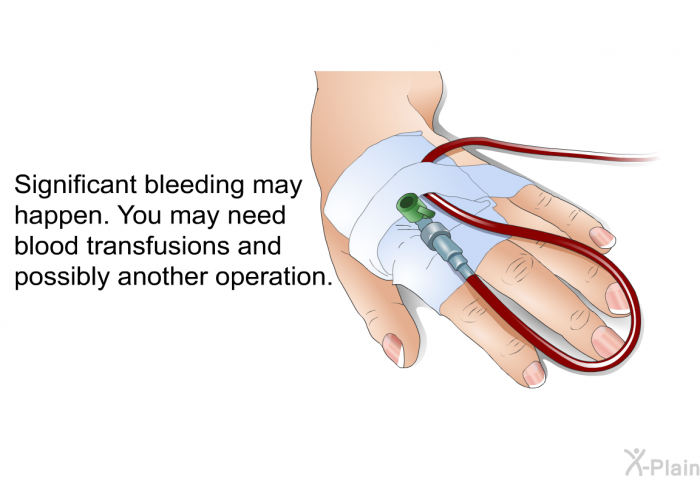 Significant bleeding may happen. You may need blood transfusions and possibly another operation.