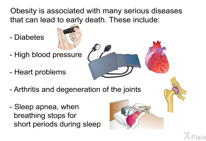 Obesity is associated with many serious diseases that can lead to early death. These include:  Diabetes; High blood pressure; Heart problems; Arthritis and degeneration of the joints; Sleep apnea, when breathing stops for short periods during sleep.