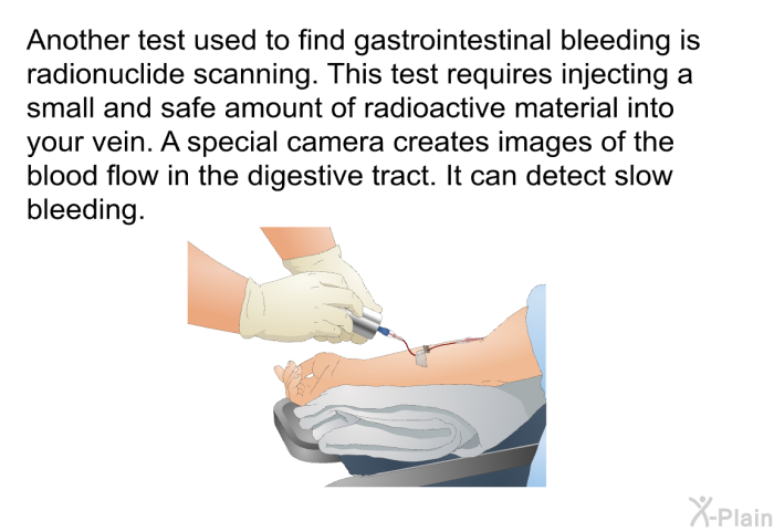 Another test used to find gastrointestinal bleeding is radionuclide scanning. This test requires injecting a small and safe amount of radioactive material into your vein. A special camera creates images of the blood flow in the digestive tract. It can detect slow bleeding.
