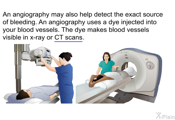 An angiography may also help detect the exact source of bleeding. An angiography uses a dye injected into your blood vessels. The dye makes blood vessels visible in x-ray or CT scans.