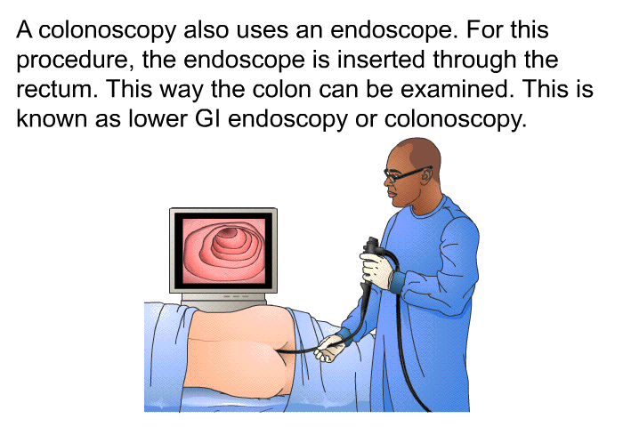 A colonoscopy also uses an endoscope. For this procedure, the endoscope is inserted through the rectum. This way the colon can be examined. This is known as lower GI endoscopy or colonoscopy.