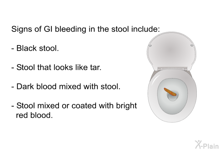 Signs of GI bleeding in the stool include:  Black stool. Stool that looks like tar. Dark blood mixed with stool. Stool mixed or coated with bright red blood.