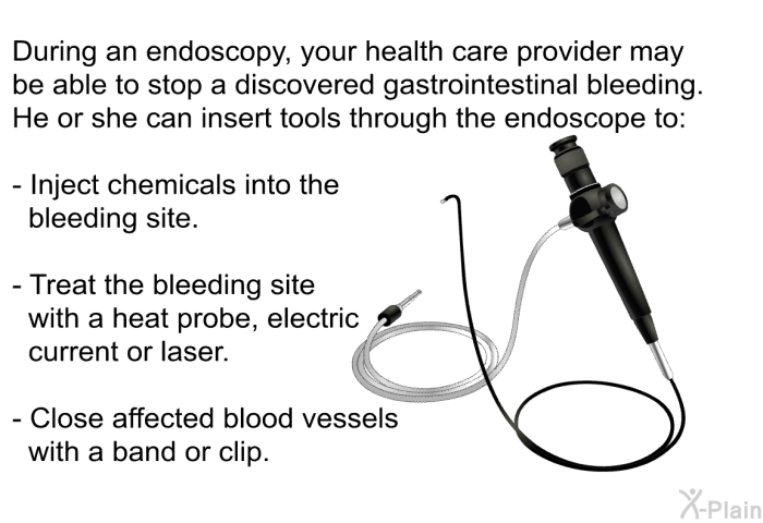 During an endoscopy, your health care provider may be able to stop a discovered gastrointestinal bleeding. He or she can insert tools through the endoscope to:  Inject chemicals into the bleeding site. Treat the bleeding site with a heat probe, electric current or laser. Close affected blood vessels with a band or clip.